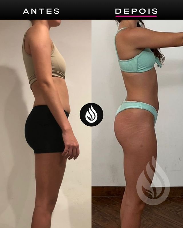 Antes e depois de aluno, evolução 6