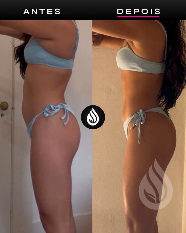 Antes e depois de aluno, evolução 9