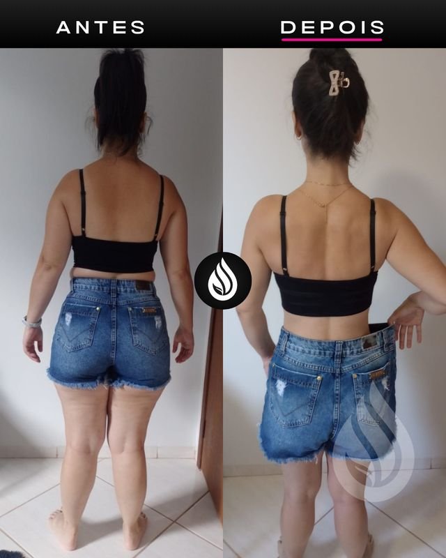 Antes e depois de aluno, evolução 10