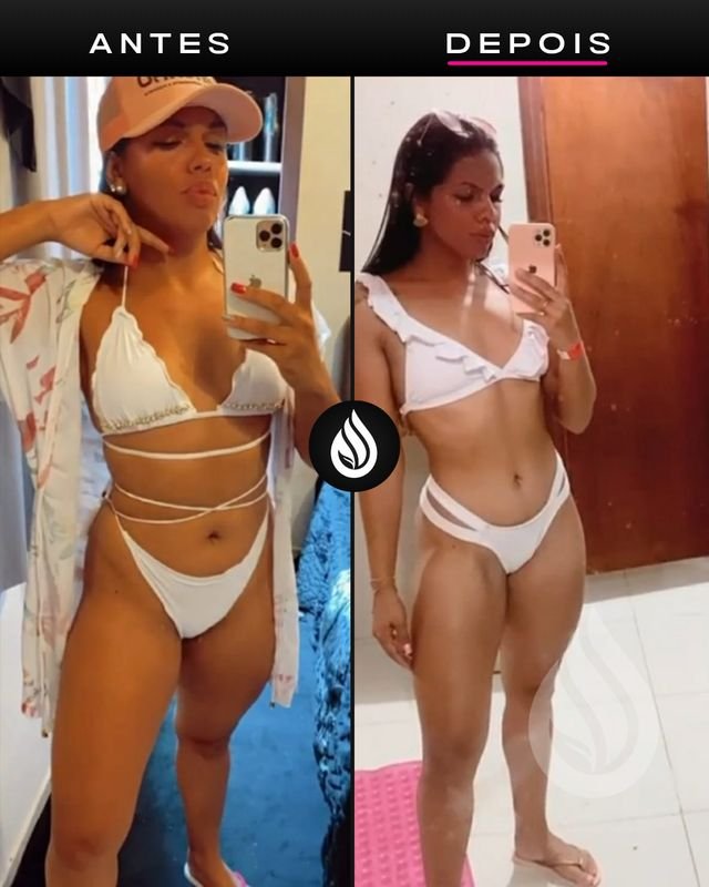 Antes e depois de aluno, evolução 41