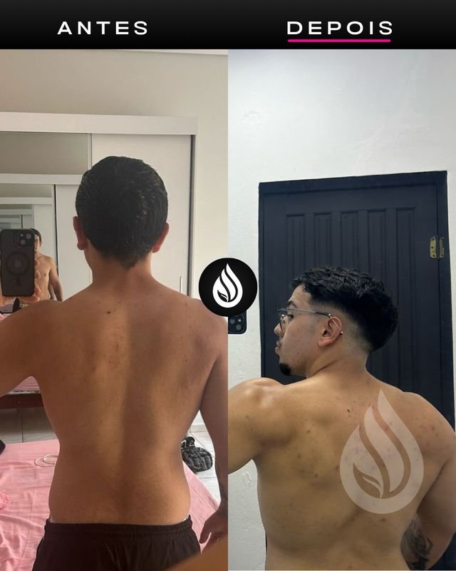 Antes e depois de aluno, evolução 62